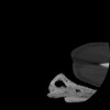 SPORK, NICO - 22.03.1976 - 02.08.2022 - CT obere Extremität - 17:51:17